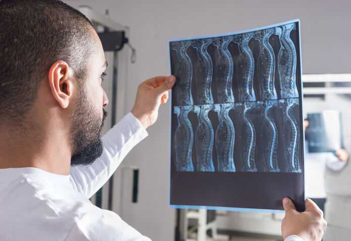 Spinal Cord Injury Lawyers in Hilton Head, SC - Doctor looking at spine x-ray