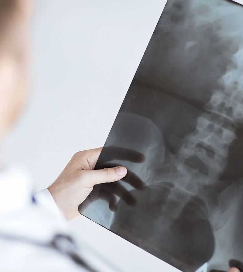 Louisville Spinal Cord Injury Attorneys - spinal cord scan