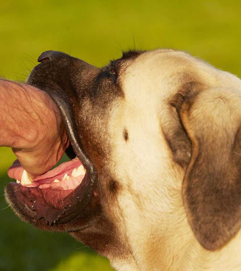 Jackson Dog Bite Attorneys - dog biting human hand