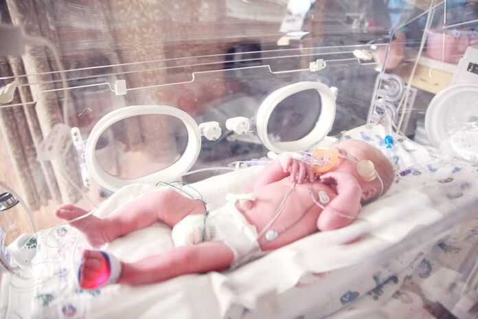 How to Find the Best Birth Injury Lawyers in Alpharetta - newborn baby with birth injuries