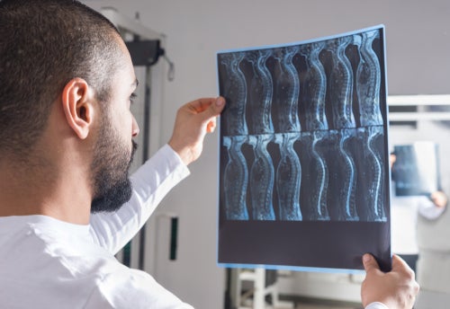 Spinal Cord Injuries After a Car Accident: What Do I Need to Know - spinal cord scans