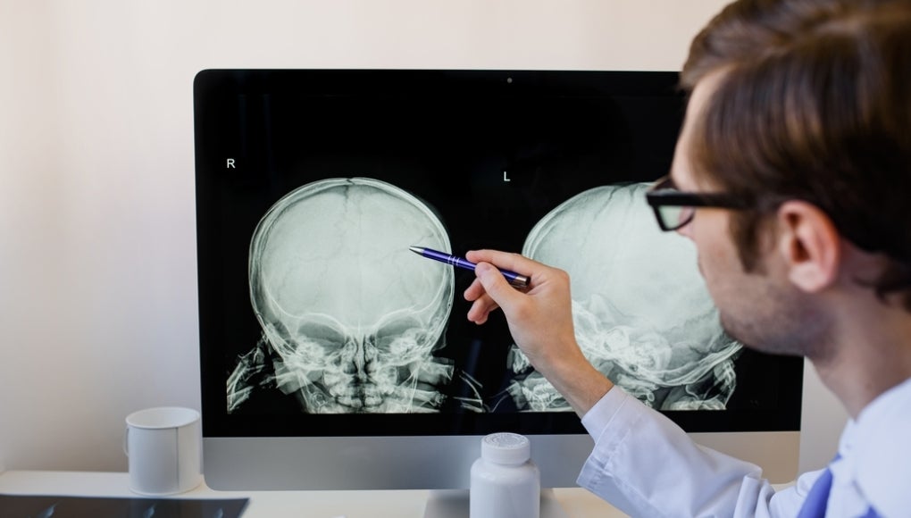 radiologist analyzing a child skull x ray