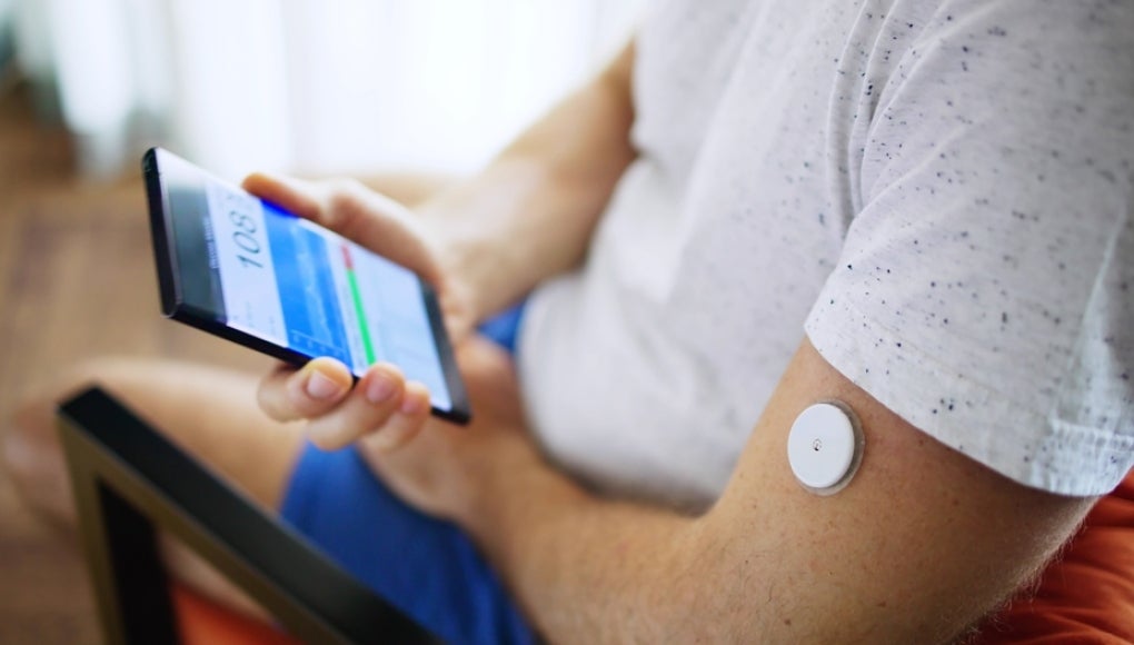 glucose monitoring