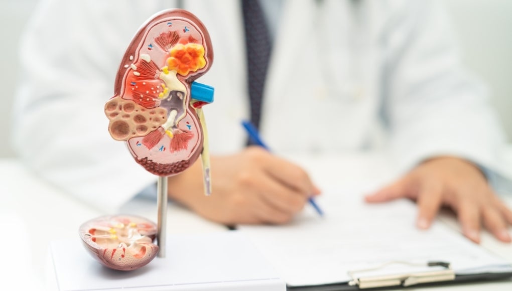 Kidney