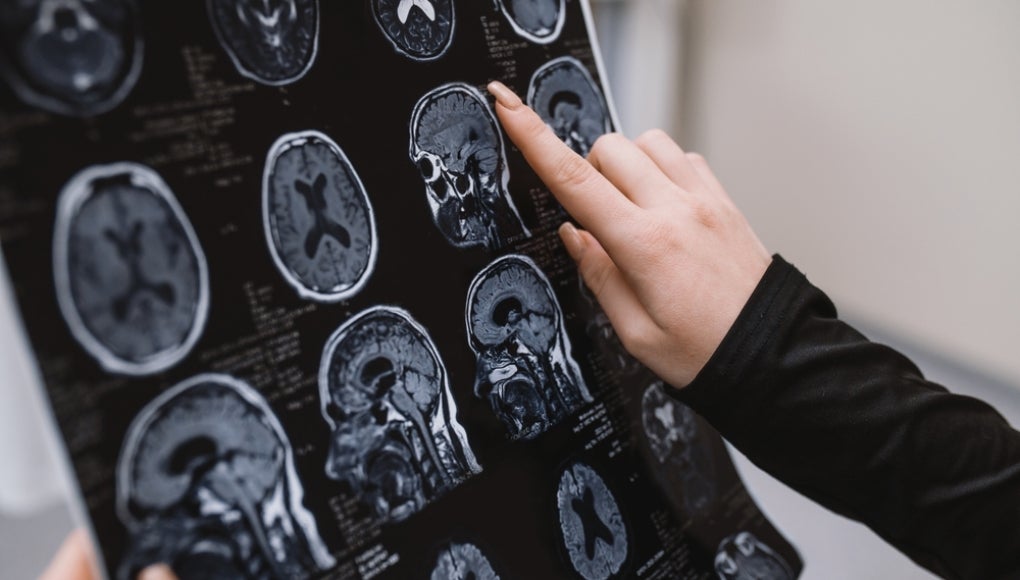 brain scan