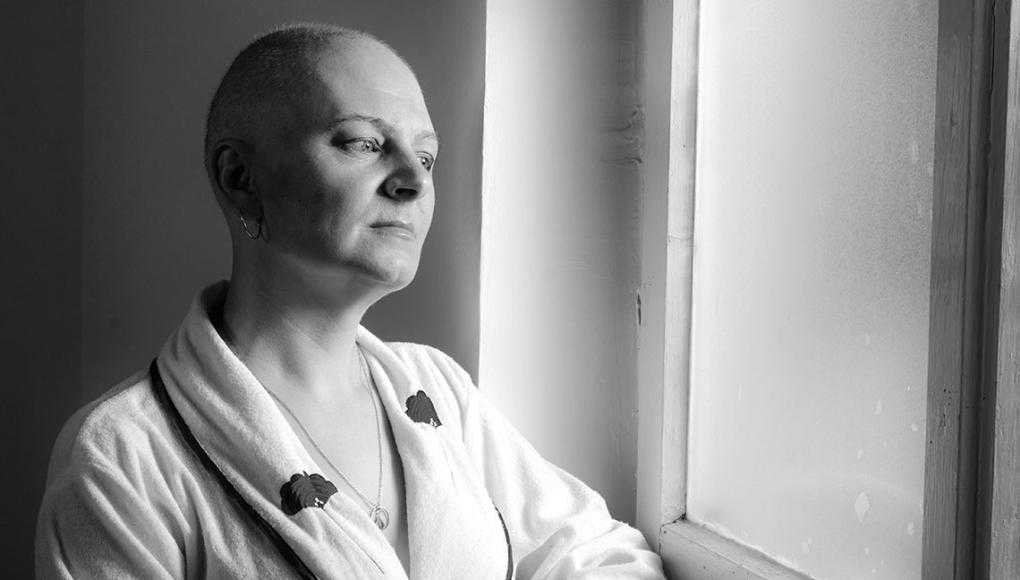 After Chemo: What It's Like for Breast Cancer Patients to Live with Permanent Hair Loss - hair loss