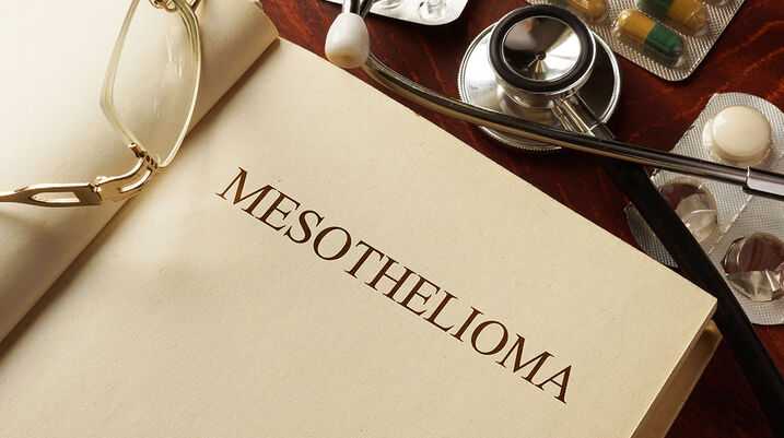 Just Diagnosed with Mesothelioma: 5 Things You Should Do Now - Book