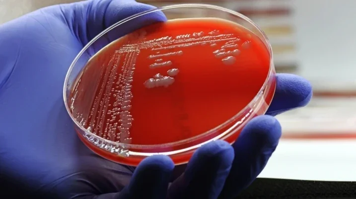 MRSA Infection