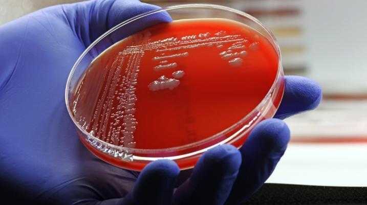 MRSA Infection