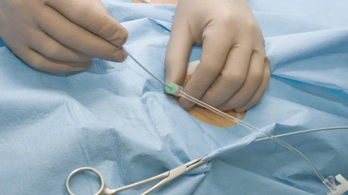 Doctor inserting catheter