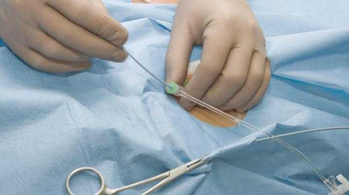 Doctor inserting catheter