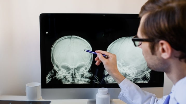 radiologist analyzing a child skull x ray