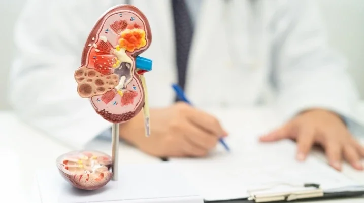 Kidney