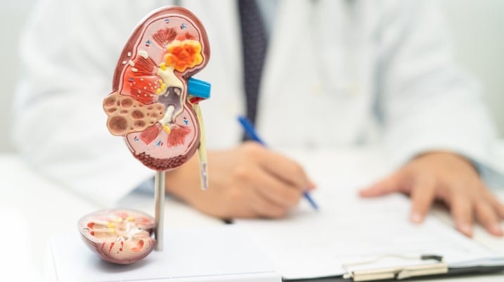 Kidney