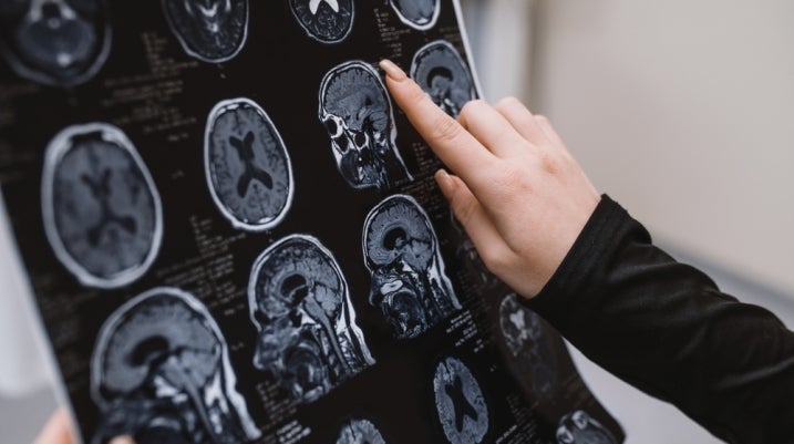 brain scan