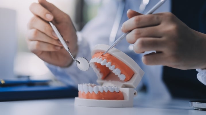 dentist showing a set of teeth