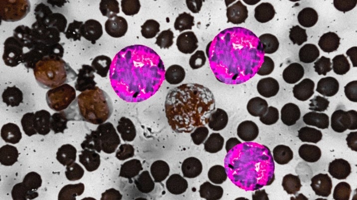 cancer cells