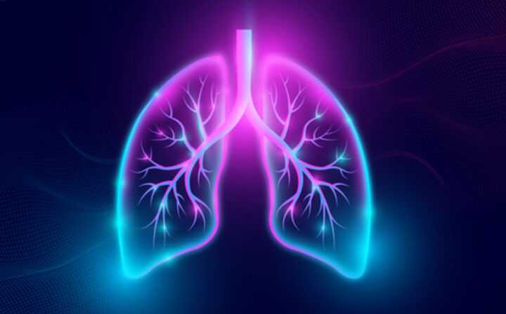 What You Need to Know About Stage 4 Mesothelioma - lung scan
