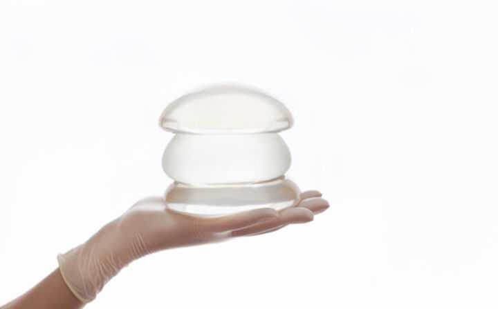What Is the Breast Implant Lawsuit Process - doctor holding breast implant