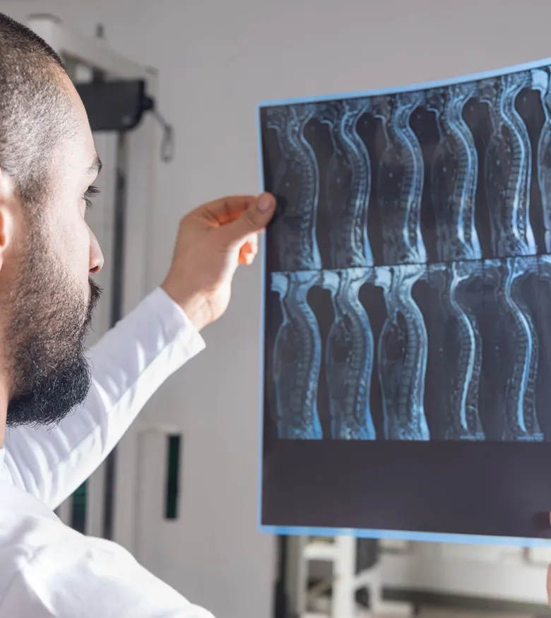 Spinal Cord Injury Lawyers in Hilton Head, SC - Doctor looking at spine x-ray