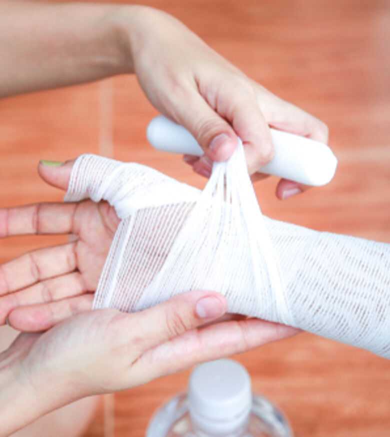 Bandaging a burn wound on hand, contact a burn injury attorney in Marietta for help.