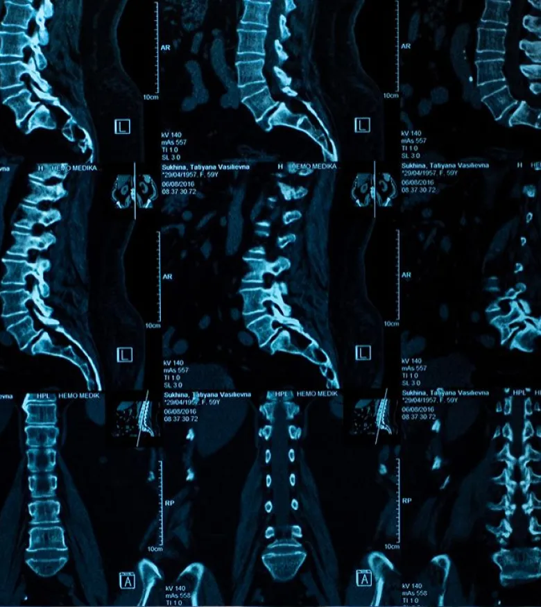spine injury scans