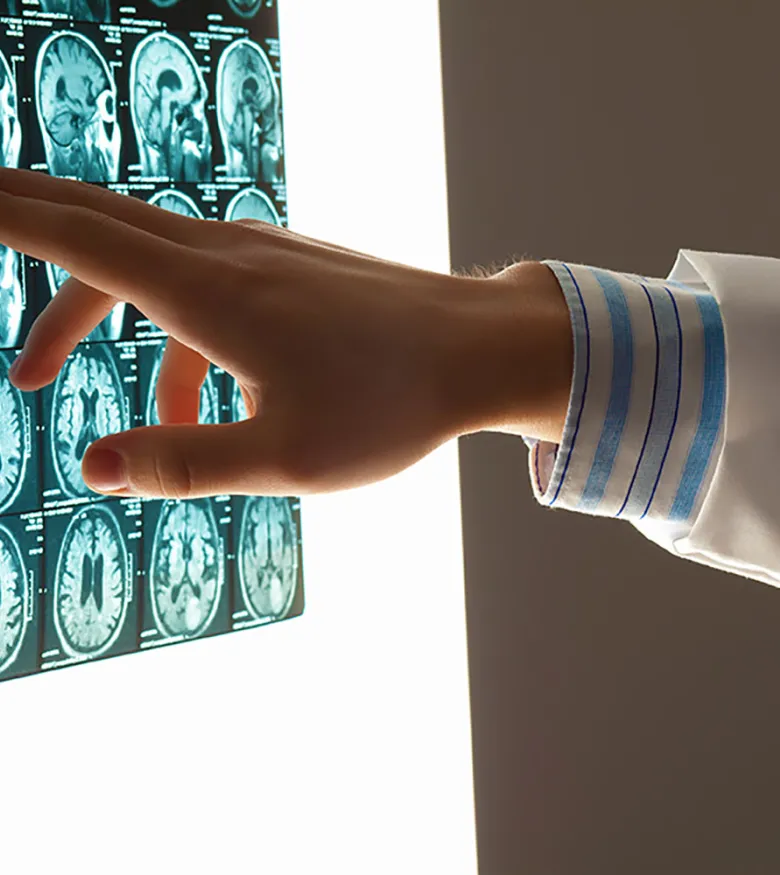 Brain Injury Attorneys in Nashville, TN - Brain injury Scan