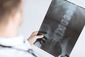 Kissimmee Spinal Cord Injury Attorneys - nurse looking at spinal cord scan 