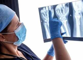 Is Hiring a Broken Bones Lawyer Important in Chicago - Doctor reviewing xray of broken bone