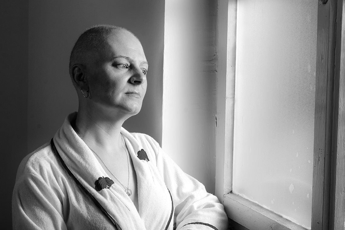 What It's Like to Live with Permanent Hair Loss After Chemo